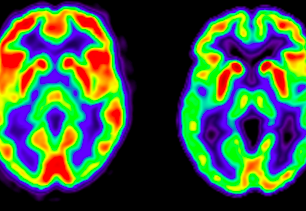 Gli Engrammi : Le Immagini della Mente