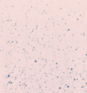 Blurry Dots
