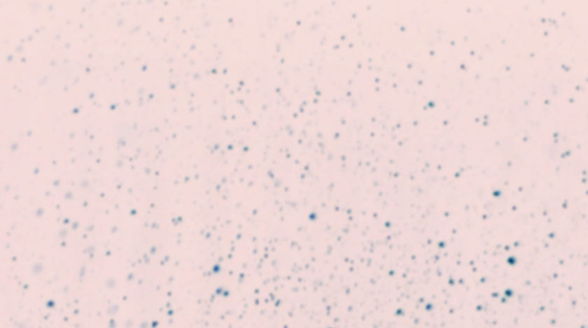 Blurry Dots