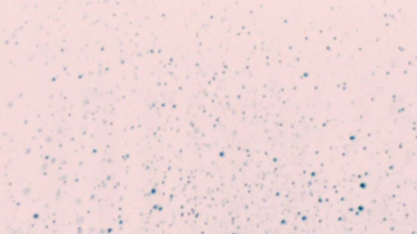 Blurry Dots