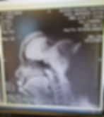 Joyce Noel-Merisier MRI