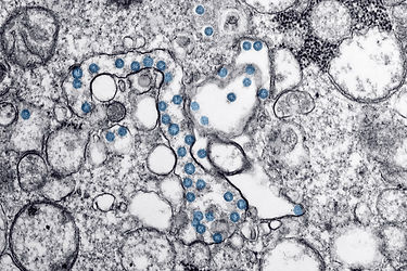 unsplash_cdc_virus_zoom.jpeg