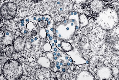 unsplash_cdc_virus_zoom.jpeg