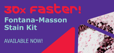 fontana_masson_button.jpg