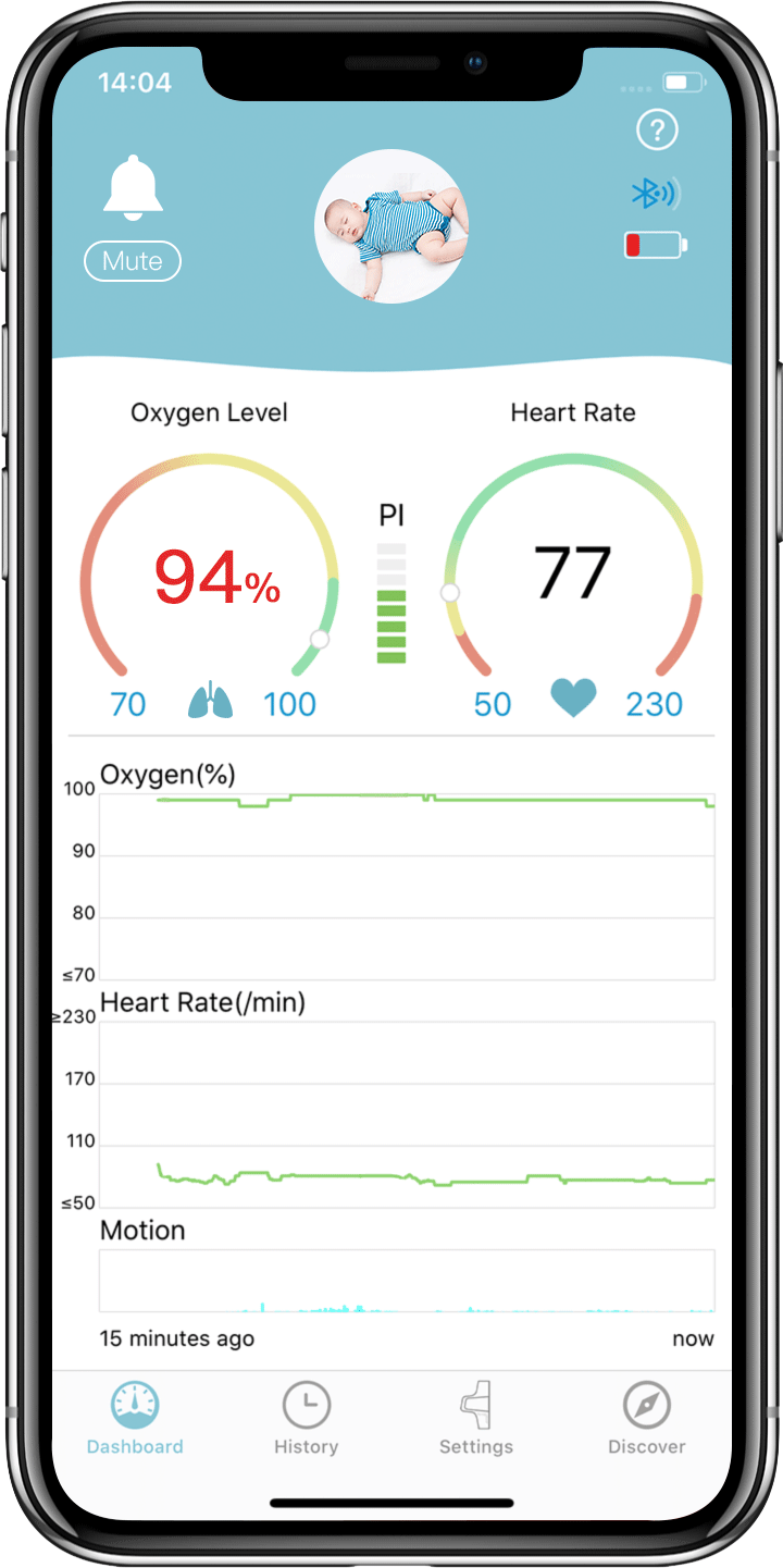 Miniatura: BABY WRIST Saturimetro NEONATALE