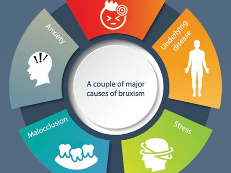 Bruxism Management