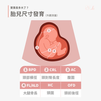 超音波