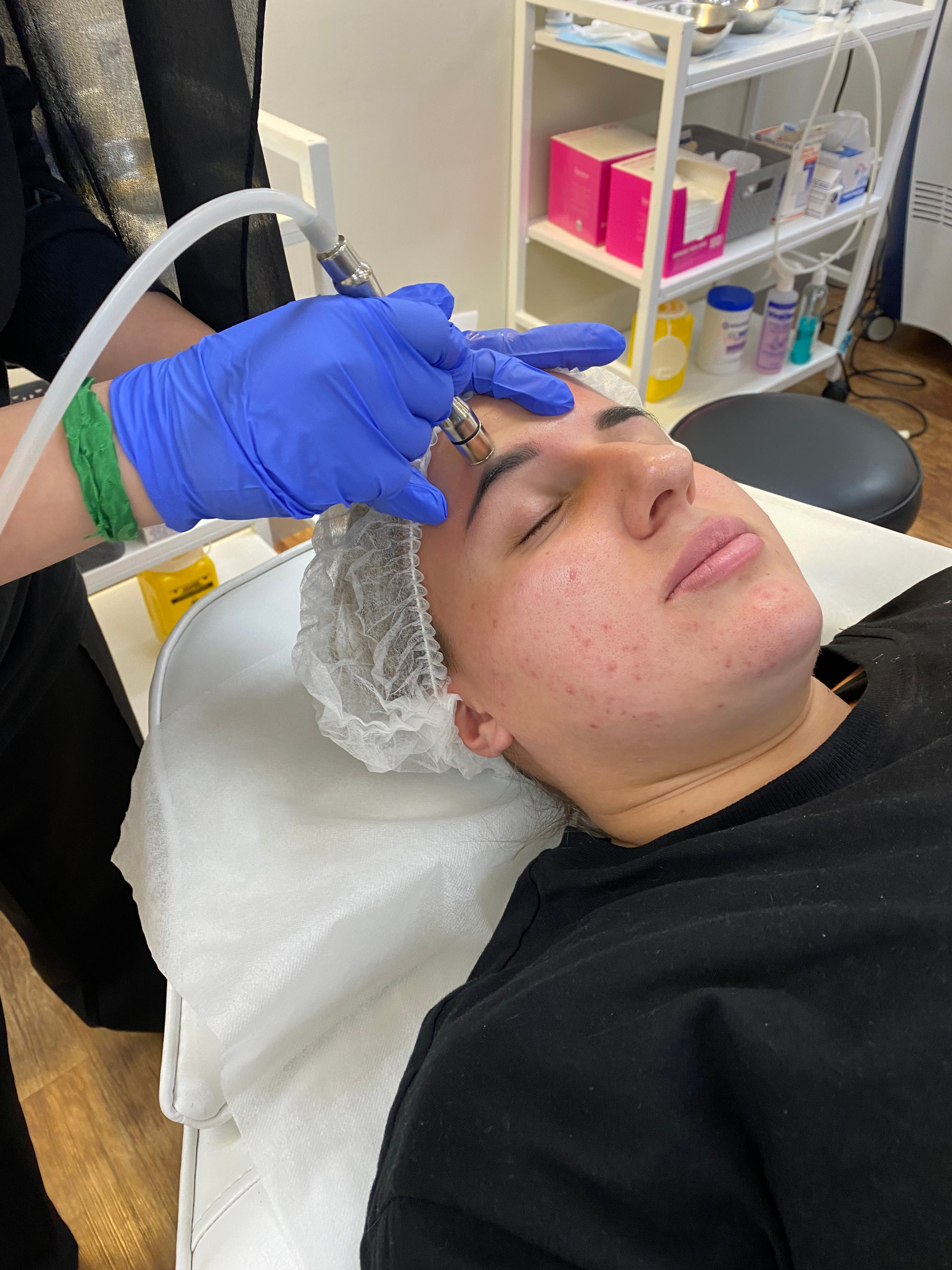 microdermabrasion session on a client