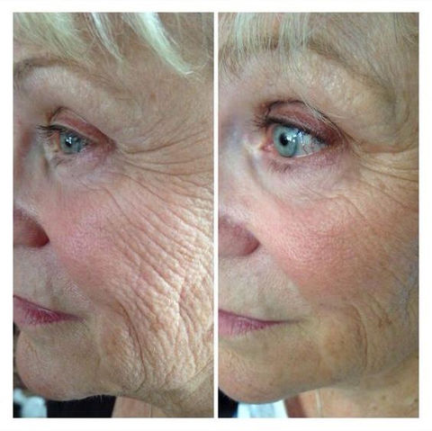 Prima e dopo 023.jpg