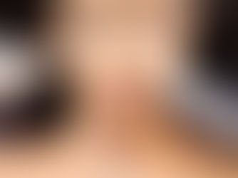 The importance of Treating the Full face as a whole with Filler. Say no to individual areas