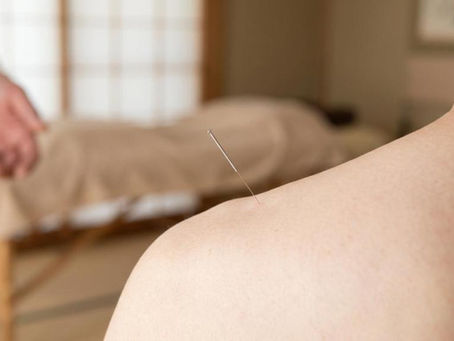 Akupunktur vs. fysioterapi vs. massage ved smerter: hvornår giver hvad mening?