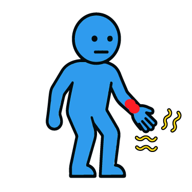 手根管症候群ピクトグラム