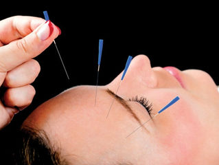 Key differences between Japanese and Chinese Acupuncture...