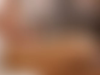 Why Cupping Therapy can benefit you today!