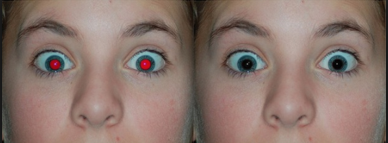 Red eye removal.