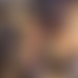 Avanço com Polilaminina; Brumadinhense com lesão medular apresenta movimentos após terapia experimental