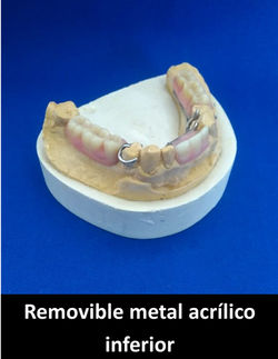 Removible_metal_acrílico_inferior