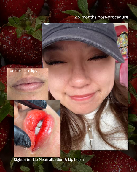 before bare lips (1).png