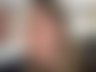 Vejo uma mosquinha voando: o que pode ser?