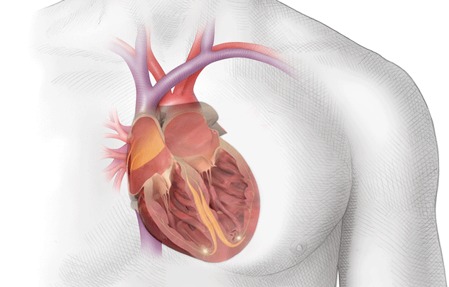 Palpitaciones-cardiacas-2.gif
