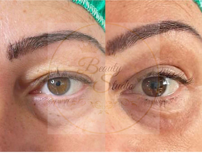 Progetto senza titolo (25).png