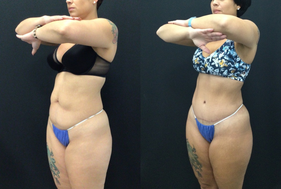 3 months before and after (1).jpg