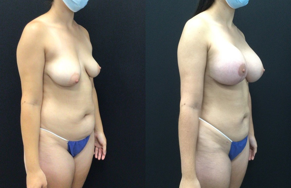 6 weeks before and after copy.jpg