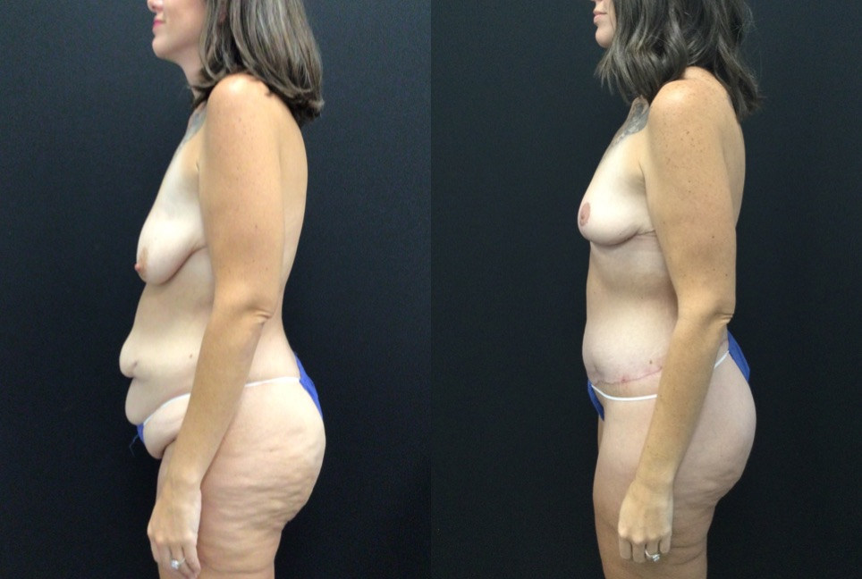 6 weeks before and after.jpg