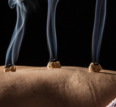 Moxibustion for Fertility Support in Miami