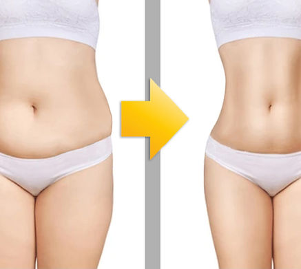 Body Reshaping.jpg