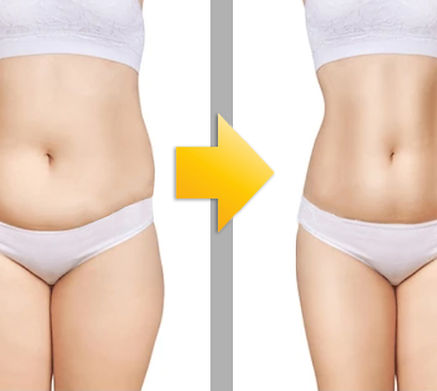 Body Reshaping.jpg