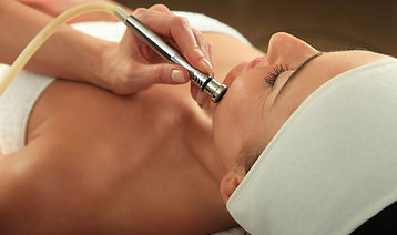 La Microdermoabrasión con punta de diamante está….jpg