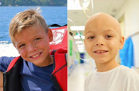 boy-diagnosed-with-wilms-tumor-before-and-after-diagnosis.jpeg