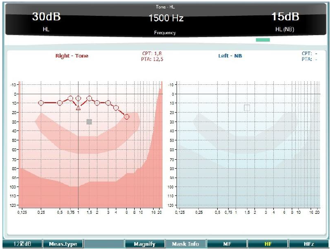 High Frequency Audiometry