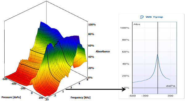Wide Band Tympanometry