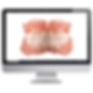 Computer image of full dentures created by Lakeview Dental Rotorua and Taupo