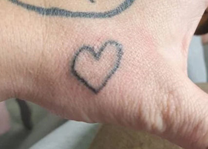 Stick & Poke Tattoos are Temporary? Really?