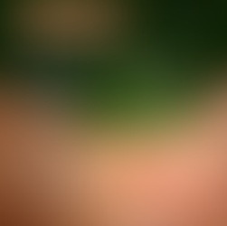 Непрохані гості - кліщі!