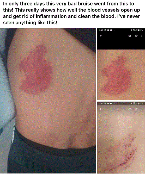 b4after.GIF
