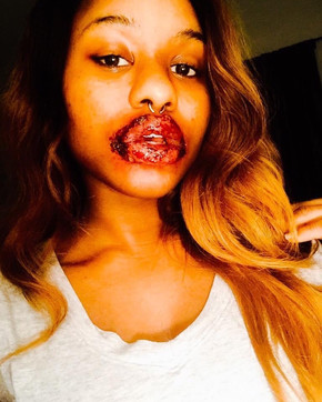 lip.jpeg