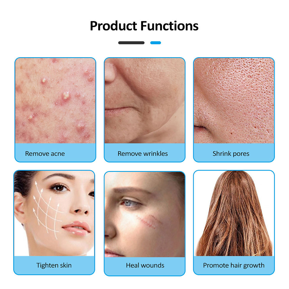 Miniatura: Aparelho de Alta Frequência Portátil Darsonval - Tratamento Antiacne de Clínica