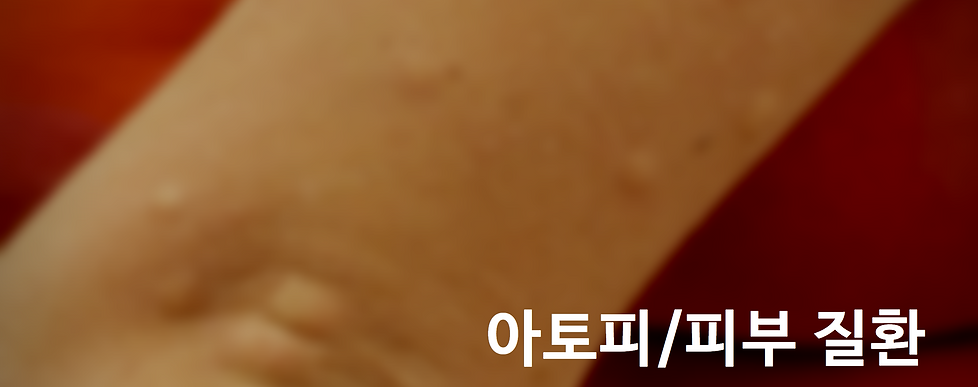 아토피질환.png