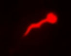 Retinal axon projection