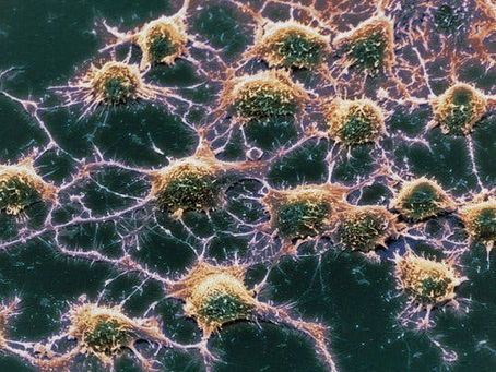 Teste sanguíneo para Alzheimer? Novos avanços.