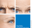 Faltenreduktion durch Botox