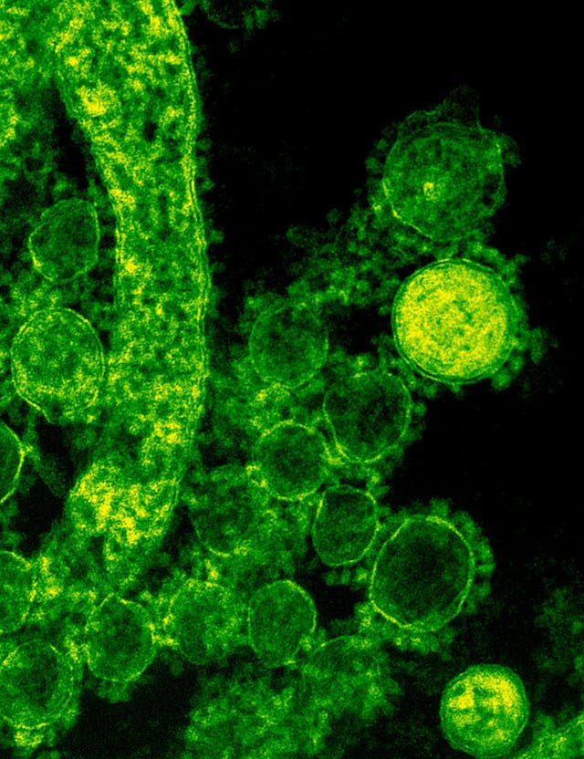 How Do Gut Bacteria Affect Your Sleep and What You Can Do About It?