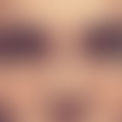 A woman's freckled face.