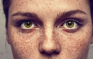 A woman's freckled face.