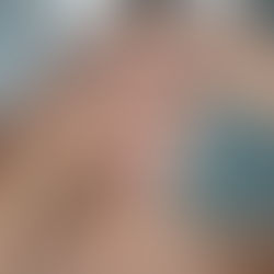 Unveiling the Link between Anxiety and Skin Sensitivity: What You Didn't Know