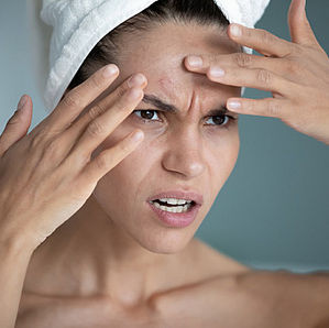 Unveiling the Link between Anxiety and Skin Sensitivity: What You Didn't Know